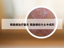 银翘病治疗偏方 银翘病吃什么中成药