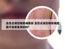 急性点滴型银屑病原因 急性点滴型银屑病是最不容易复发的吗?