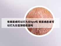 有银屑病可以打九价hpv吗 银屑病患者可以打九价宫颈癌疫苗吗