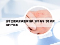 济宁正规银屑病医院预约 济宁有专门看银屑病的中医吗