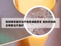 衡阳哪家医院治疗银屑病最便宜 衡阳皮肤病去哪里治疗最好