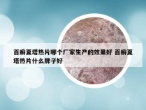 百癣夏塔热片哪个厂家生产的效果好 百癣夏塔热片什么牌子好