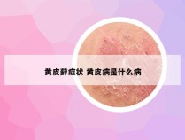 黄皮藓症状 黄皮病是什么病