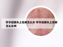 怀孕后额头上出癣怎么办 怀孕后额头上出癣怎么办啊