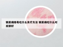 银屑病排毒吃什么食疗方法 银屑病吃什么对皮肤好