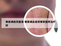 银屑病南京医保 银屑病去南京哪家医院治疗好