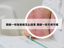 跟癣一样有些痒怎么回事 跟癣一样不疼不痒