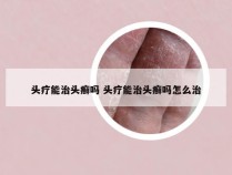 头疗能治头癣吗 头疗能治头癣吗怎么治