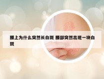 腰上为什么突然长白斑 腰部突然出现一块白斑