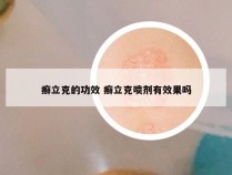 癣立克的功效 癣立克喷剂有效果吗