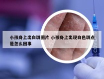 小孩身上出白斑图片 小孩身上出现白色斑点是怎么回事