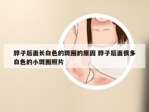 脖子后面长白色的斑圈的原因 脖子后面很多白色的小斑圈照片