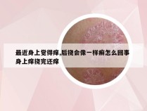 最近身上觉得痒,后挠会像一样癣怎么回事 身上痒挠完还痒