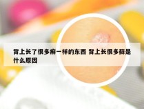 背上长了很多癣一样的东西 背上长很多藓是什么原因