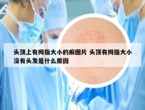 头顶上有拇指大小的癣图片 头顶有拇指大小没有头发是什么原因