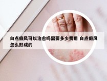 白点癫风可以治愈吗需要多少费用 白点癫风怎么形成的