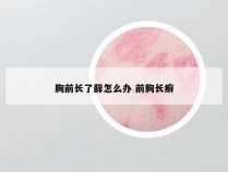 胸前长了藓怎么办 前胸长癣