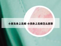 小朋友身上出癣 小孩身上出癣怎么回事