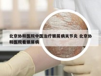 北京协和医院中医治疗银屑病关节炎 北京协和医院看银屑病