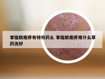 掌指脓疱疹有特效药么 掌指脓疱疹用什么草药洗好