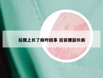 后腰上长了癣咋回事 后背腰部长癣