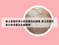 身上出现许多小白点是怎么回事 身上出现许多小白点是怎么回事啊