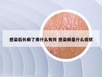 感染后长癣了用什么有效 感染癣是什么症状