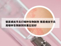 银屑病关节炎打哪种生物制剂 银屑病关节炎用哪种生物制剂效果比较好