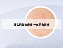 什么药膏去癣好 什么药去藓好