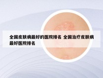 全国皮肤病最好的医院排名 全国治疗皮肤病最好医院排名