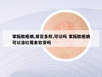 掌跖脓疱病,用百多邦,可以吗 掌跖脓疱病可以涂红霉素软膏吗