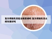 复方樟脑乳膏能治银屑病吗 复方樟脑乳膏止痒效果好吗