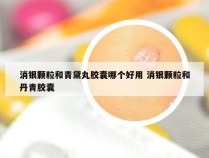 消银颗粒和青黛丸胶囊哪个好用 消银颗粒和丹青胶囊