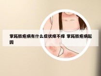 掌跖脓疱病有什么症状痒不痒 掌跖脓疱病起因