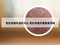 克比热提片治疗什么 克比热提片是激素药吗