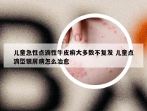 儿童急性点滴性牛皮癣大多数不复发 儿童点滴型银屑病怎么治愈