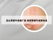 怎么举报牛皮癣广告 如何举报牛皮鲜电话