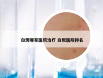 白斑哪家医院治疗 白斑医院排名