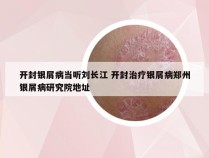 开封银屑病当听刘长江 开封治疗银屑病郑州银屑病研究院地址