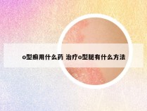 o型癣用什么药 治疗o型腿有什么方法