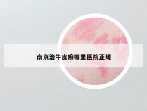 南京治牛皮癣哪里医院正规