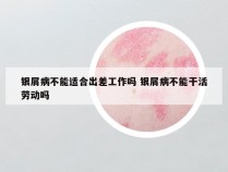 银屑病不能适合出差工作吗 银屑病不能干活劳动吗