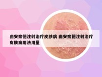 曲安奈德注射治疗皮肤病 曲安奈德注射治疗皮肤病用法用量