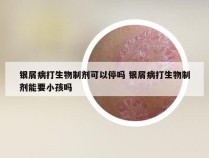 银屑病打生物制剂可以停吗 银屑病打生物制剂能要小孩吗