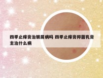 四季止痒膏治银屑病吗 四季止痒膏抑菌乳膏主治什么病