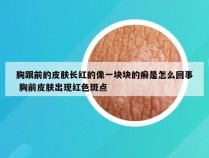 胸跟前的皮肤长红的像一块块的癣是怎么回事 胸前皮肤出现红色斑点