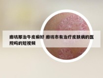 廊坊那治牛皮癣好 廊坊市有治疗皮肤病的医院吗的短视频