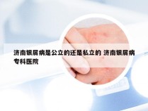 济南银屑病是公立的还是私立的 济南银屑病专科医院