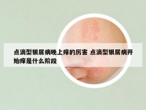 点滴型银屑病晚上痒的厉害 点滴型银屑病开始痒是什么阶段