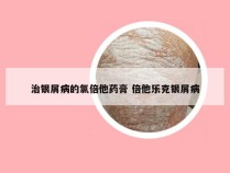 治银屑病的氯倍他药膏 倍他乐克银屑病